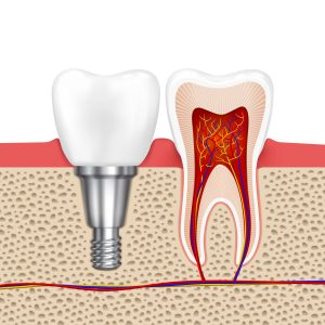 Quy trình điều trị tủy?